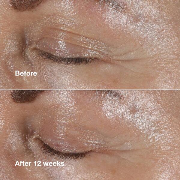 Clinique Smart Clinical Repair&#8482; Wrinkle Correcting Eye Cream