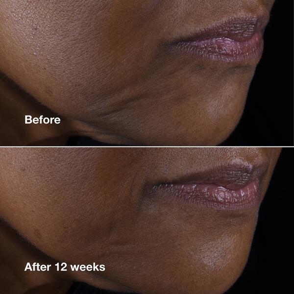 Clinique Smart Clinical Repair&#8482; Lifting Face + Neck Cream