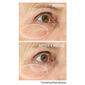 StriVectin Peptight 360 Tightening Eye Serum - image 3