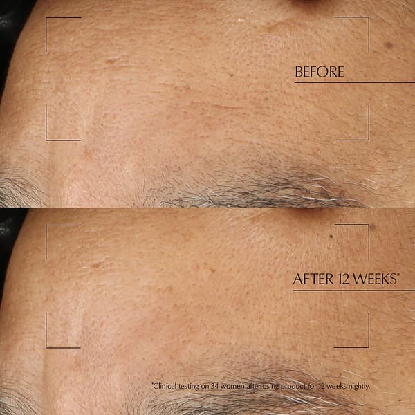 Est&#233;e Lauder&#8482; Advanced Night Repair Overnight Treatment