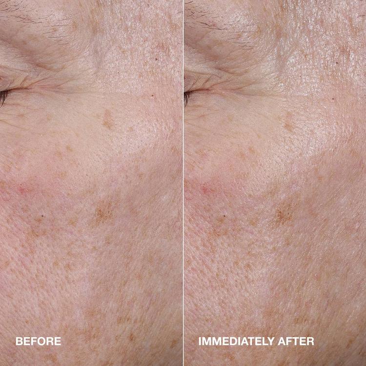 Clinique Moisture Surge Serum