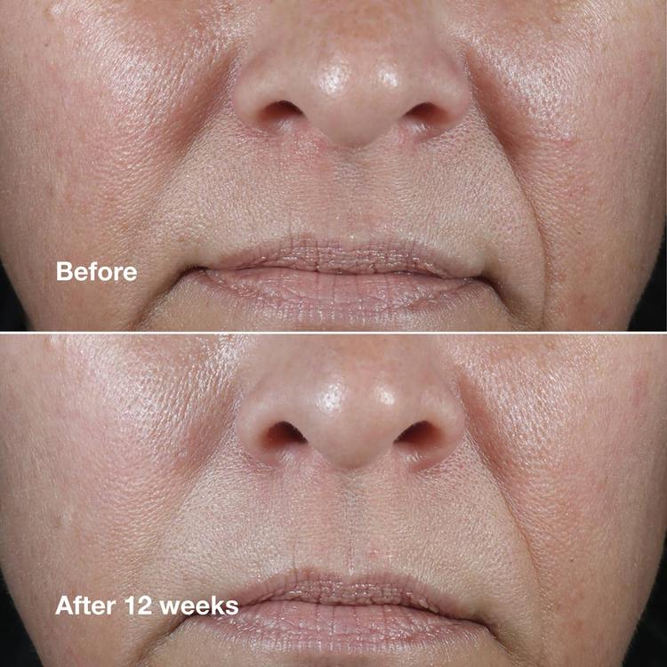 Clinique Smart Clinical Repair™ Wrinkle Correcting Rich Cream