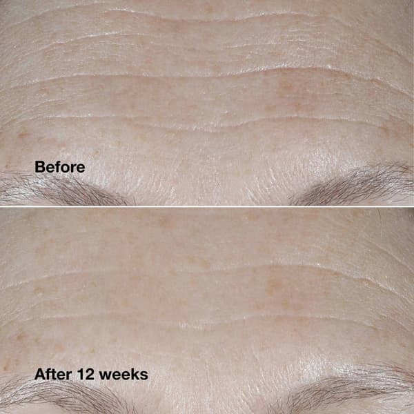 Clinique Day to Night Anti-Aging Skincare Gift Set - $157 Value