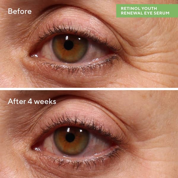 Murad Retinol Youth Renewal Eye Serum