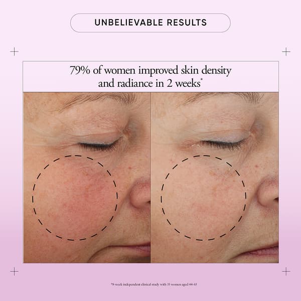 Philosophy Ultimate Miracle Worker SPF 30