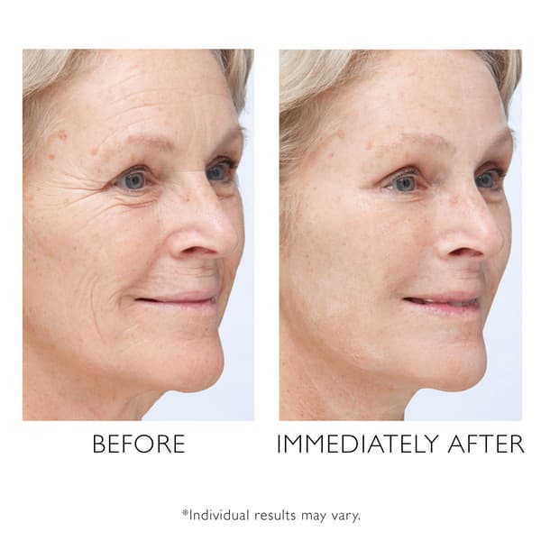 Peter Thomas Roth Instant FIRMx Temporary Face Tightener