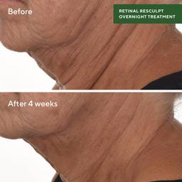 Murad Retinol Resculpt Overnight Treatment