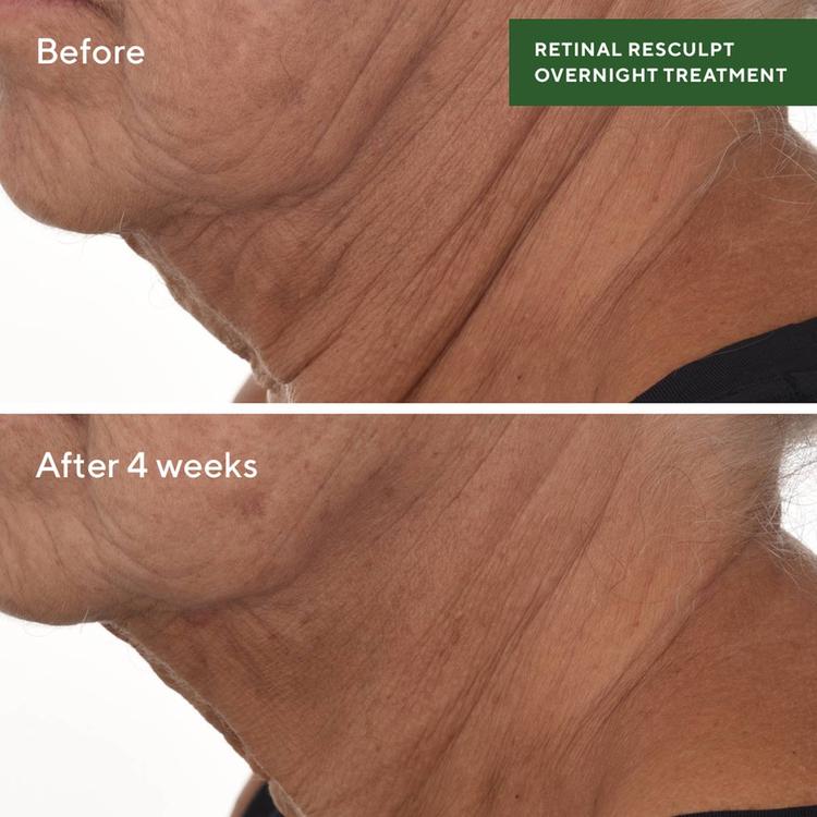 Murad Retinol Resculpt Overnight Treatment