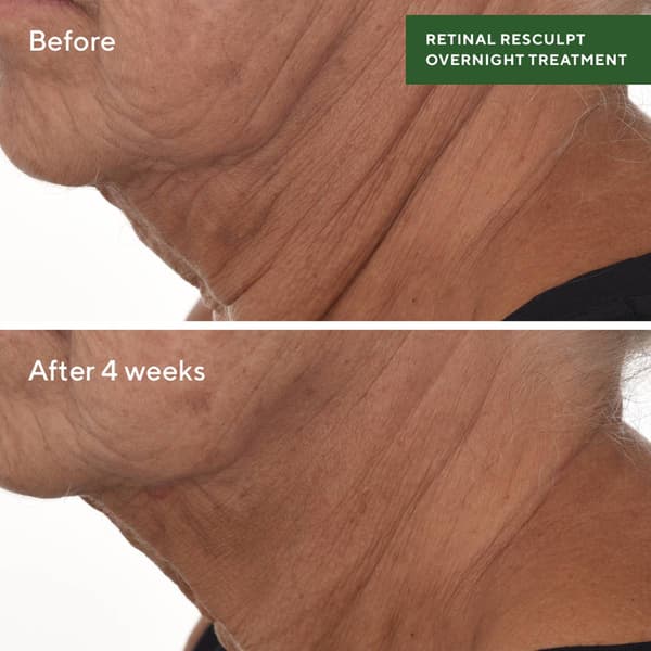 Murad Retinol Resculpt Overnight Treatment