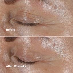 Clinique Smart Clinical Repair™ Wrinkle Correcting Eye Cream