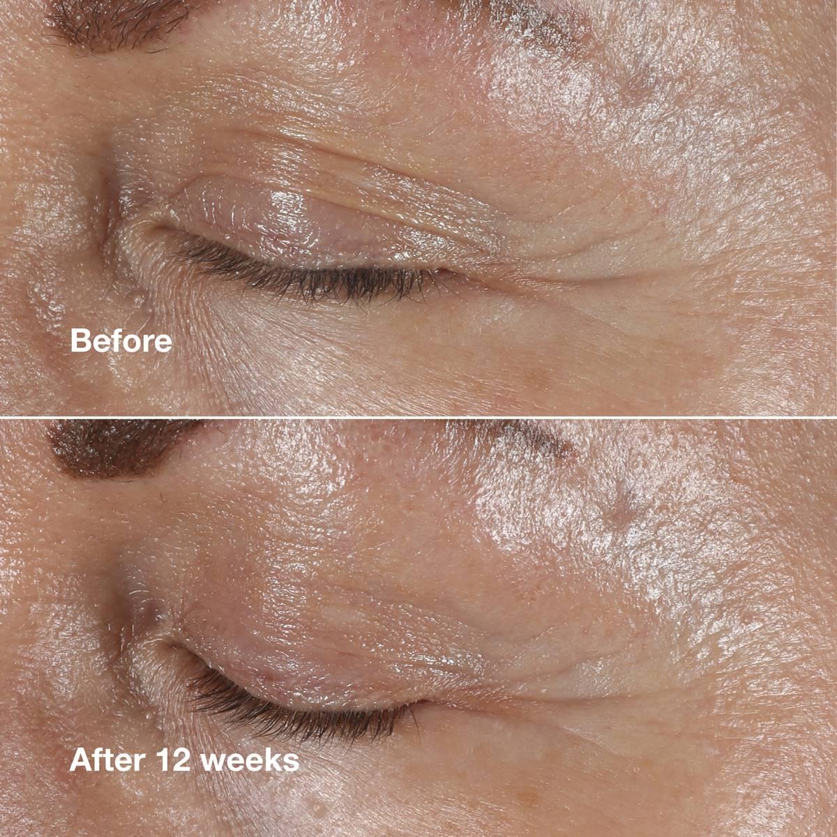 Clinique Smart Clinical Repair™ Wrinkle Correcting Eye Cream