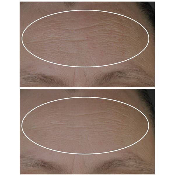 StriVectin Discovery Series Anti-Wrinkle Travel Trio