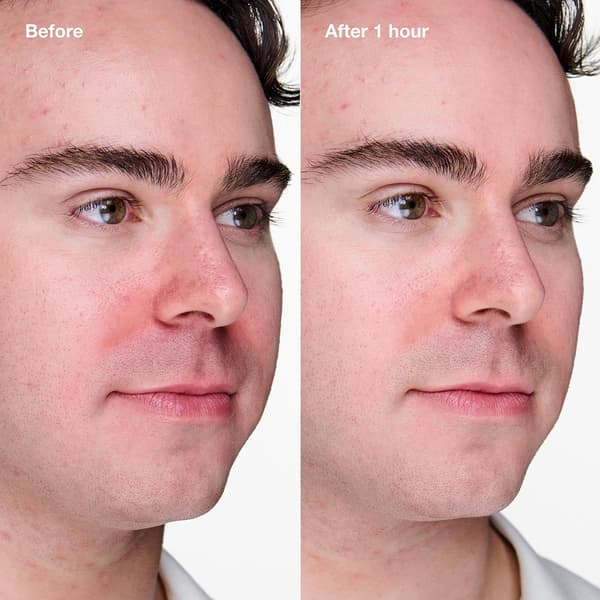 Clinique Acne Solutions Clinical Advanced Clearing Gel