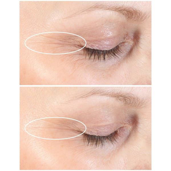 StriVectin Discovery Series Anti-Wrinkle Travel Trio