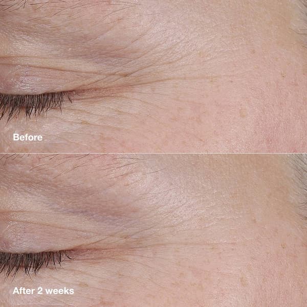 Clinique Smart Clinical Balm