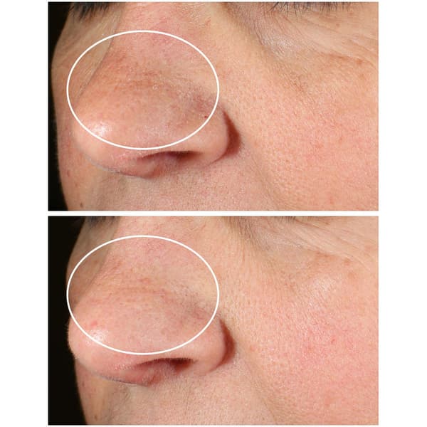 StriVectin Discovery Series: Tighten & Lift Trio Kit