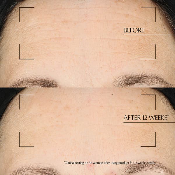 Est&#233;e Lauder&#8482; Advanced Night Repair Overnight Treatment
