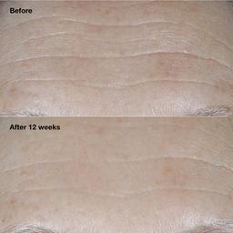 Clinique Smart Clinical Repair™ Broad Spectrum Wrinkle Cream