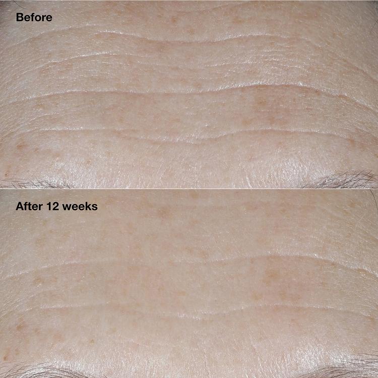 Clinique Smart Clinical Repair™ Broad Spectrum Wrinkle Cream