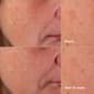 Clinique Brightening Routine: Mini Even Better Skincare Kit - image 6