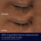 Est&#233;e Lauder&#8482; Advanced Night Repair Eye Supercharged Gel-Cream - image 4