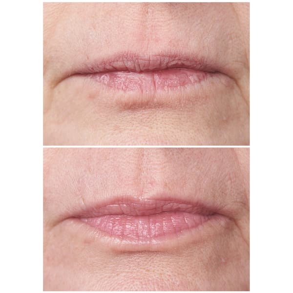 StriVectin Double Fix Lip Plumping & Vertical Line Treatment