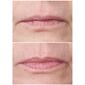 StriVectin Double Fix Lip Plumping & Vertical Line Treatment - image 2