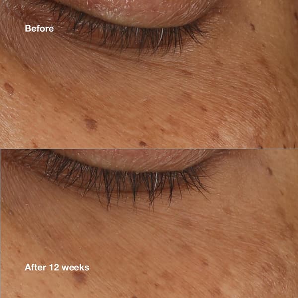 Clinique All About Eyes&#8482; Brightening Serum with Retinoid