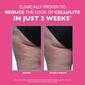 Peter Thomas Roth FIRMx Tight & Toned Cellulite Treatment - image 4