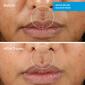 Murad Rapid Relief Acne Sulfur Mask - image 4