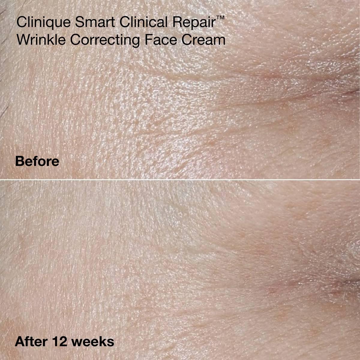 Clinique Anti-Aging Routine: Mini Smart Clinical Repair Skincare