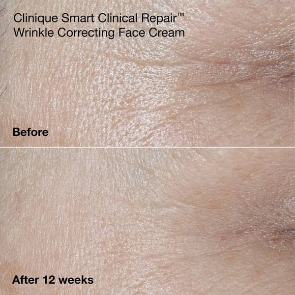 Clinique Anti-Aging Routine: Mini Smart Clinical Repair Skincare
