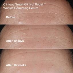 Clinique Anti-Aging Routine: Mini Smart Clinical Repair Skincare