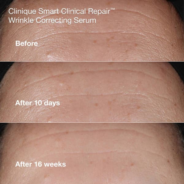 Clinique Anti-Aging Routine: Mini Smart Clinical Repair Skincare