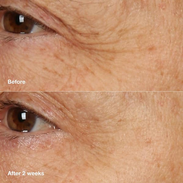 Clinique Day to Night Anti-Aging Skincare Gift Set - $157 Value