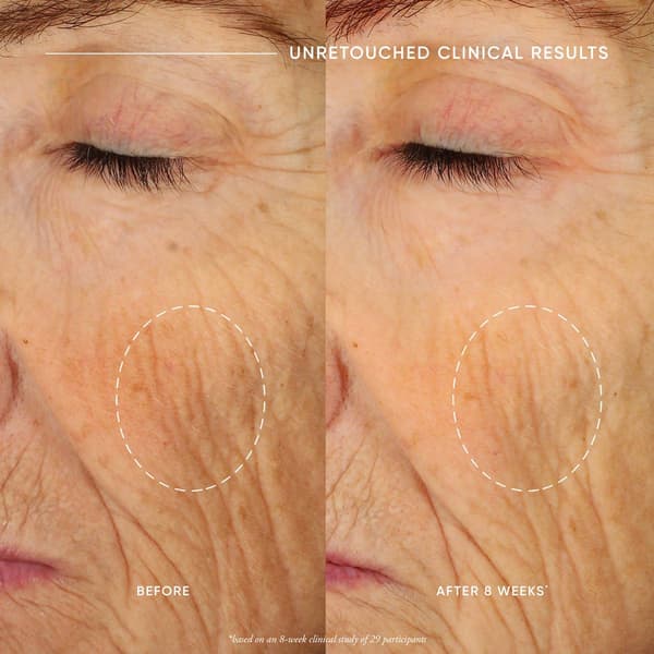 Philosophy Ultimate Miracle Worker Face &amp; Neck Cream