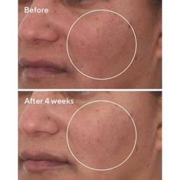 Murad Cellular Hydration Repair Serum