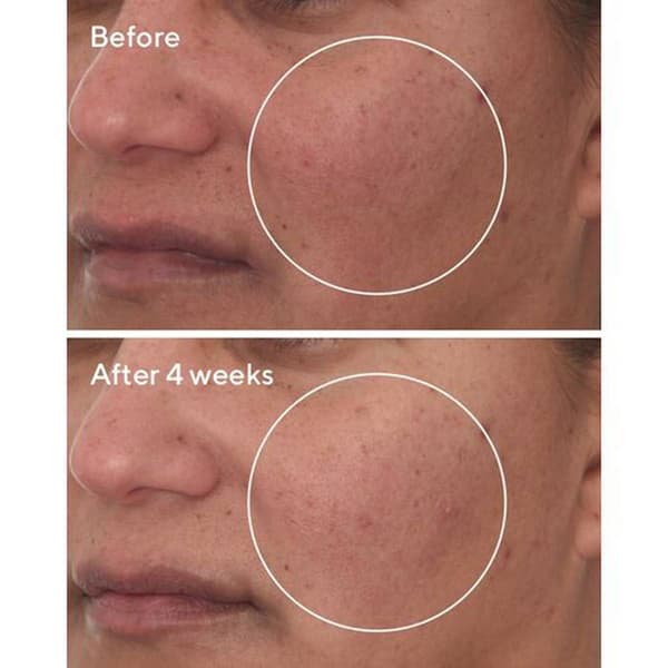 Murad Cellular Hydration Repair Serum