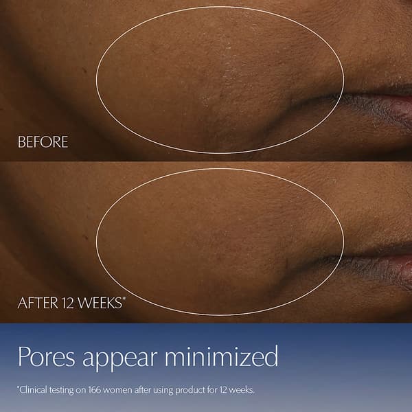 Est&#233;e Lauder&#8482; Advanced Night Repair Multi-Recovery Complex Serum