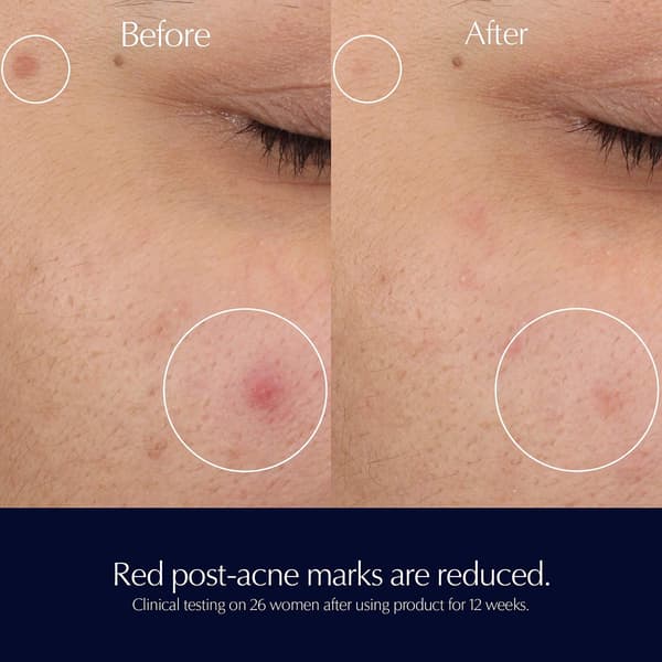 Estée Lauder™ Advanced Night Repair Rescue Solution Serum