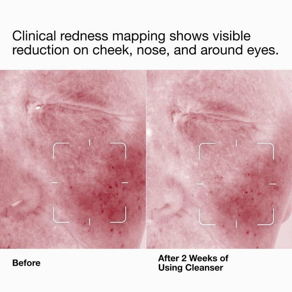 Clinique Daily Calm™ Gentle Cream Face Cleanser