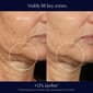 Est&#233;e Lauder&#8482; Perfectionist Pro Duo Rapid Firm + Lift Serum - image 4