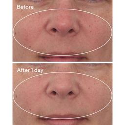 Murad Cellular Hydration Repair Mask