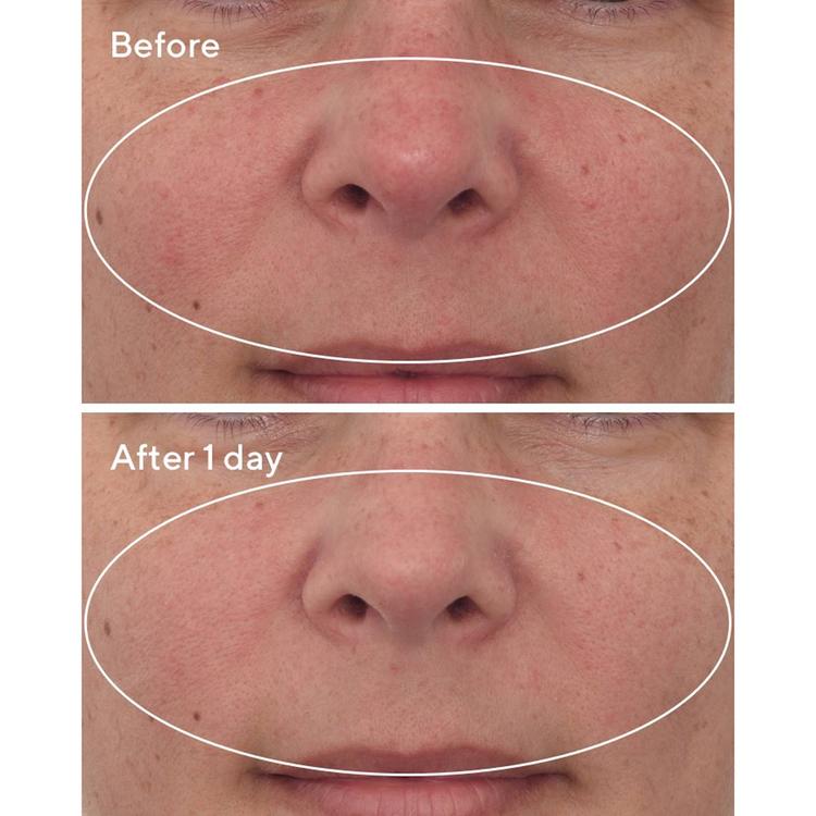 Murad Cellular Hydration Repair Mask