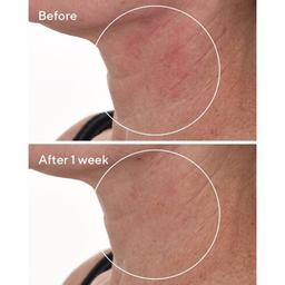 Murad Cellular Hydration Repair Serum
