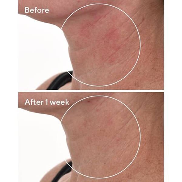Murad Cellular Hydration Repair Serum