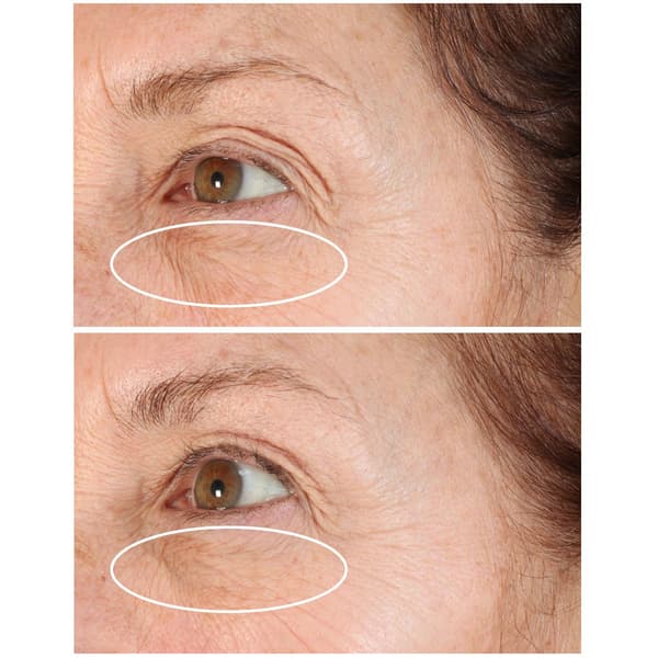 StriVectin Discovery Series: Tighten & Lift Trio Kit