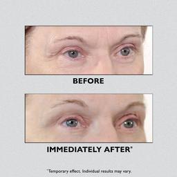 Peter Thomas Roth Instant FIRMx Temporary Eye Tightener