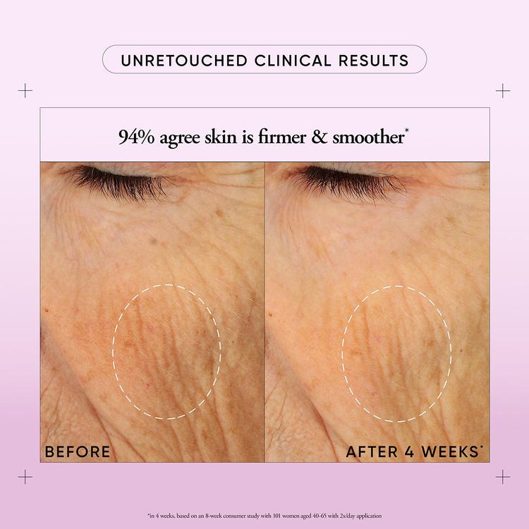Philosophy Ultimate Miracle Worker Face & Neck Cream