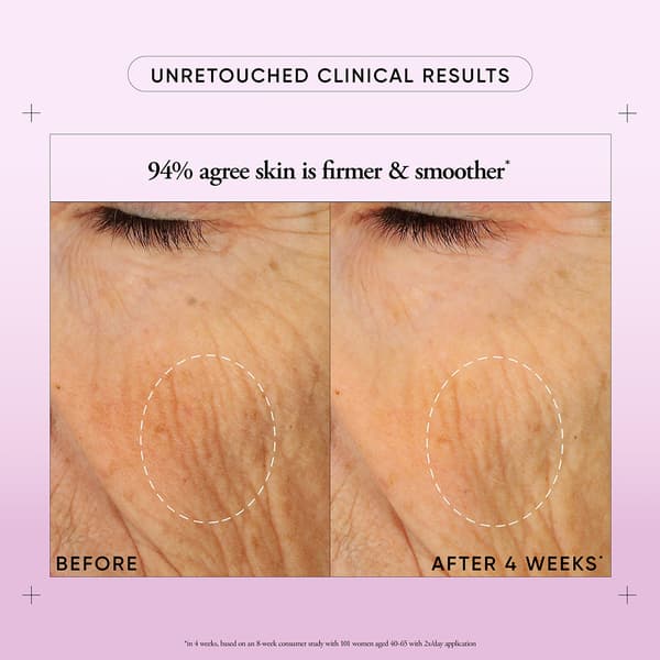 Philosophy Ultimate Miracle Worker Face & Neck Cream